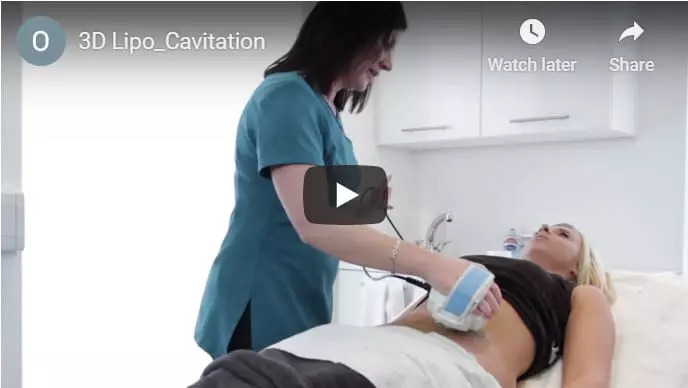 Cavitation Treatment